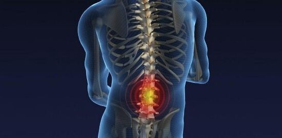 Back pain for osteoarthritis of the lumbar