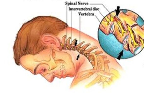 cervical bone