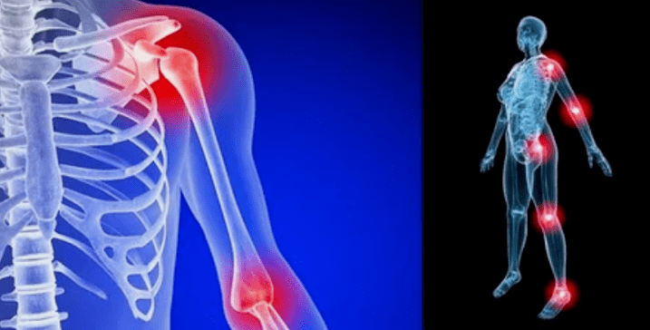 Deforming spending on arthritis
