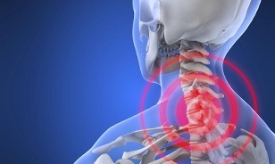 the cause of cervical bone necrosis