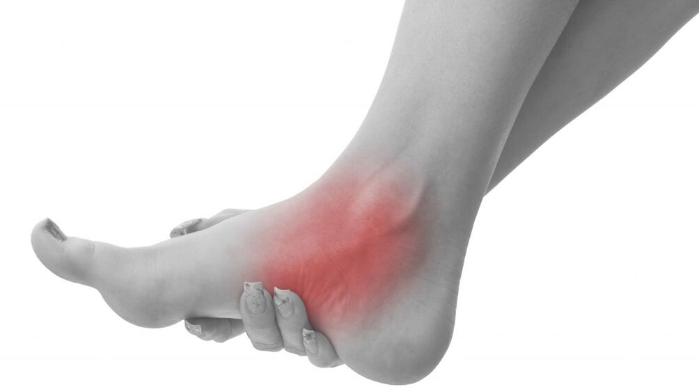Ankle joint pain due to arthritis
