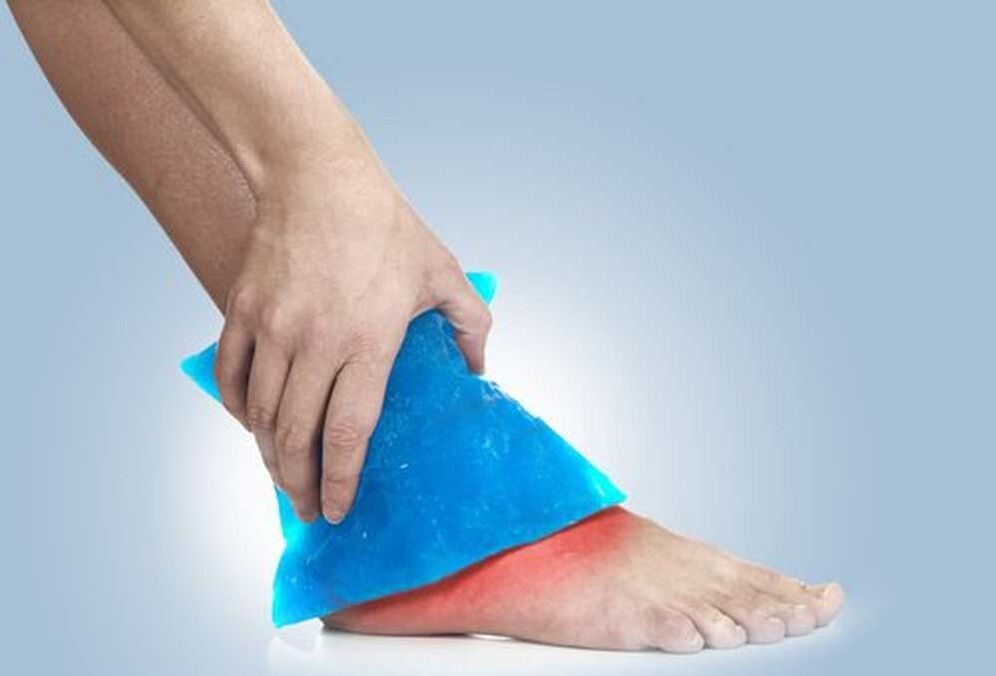 Soaking in cold water treats ankle arthritis