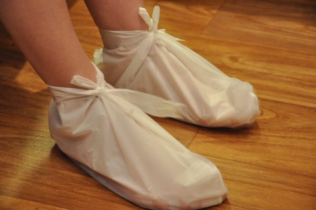 compression for ankle arthritis