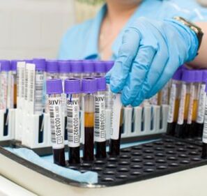 blood tests to diagnose joint pain
