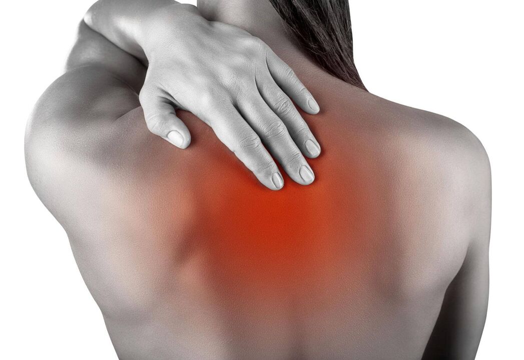 Pain due to cervical spondylosis