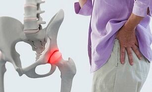 The cause of dry joints of the hip joints
