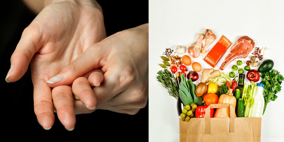 Hand arthritis and gout foods