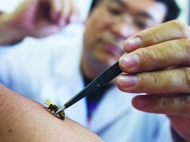 apitherapy for cervical spondylosis