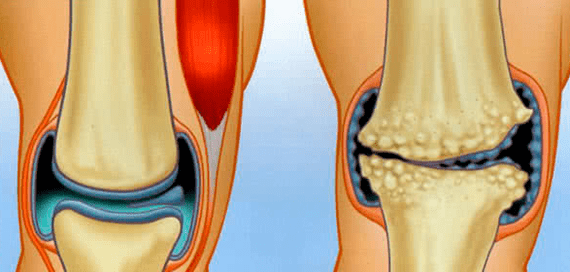 Normal joints and joints